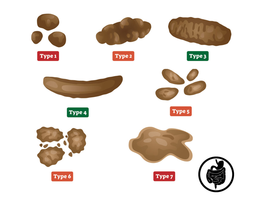 Illustration of various stages of the Bristol stool chart.