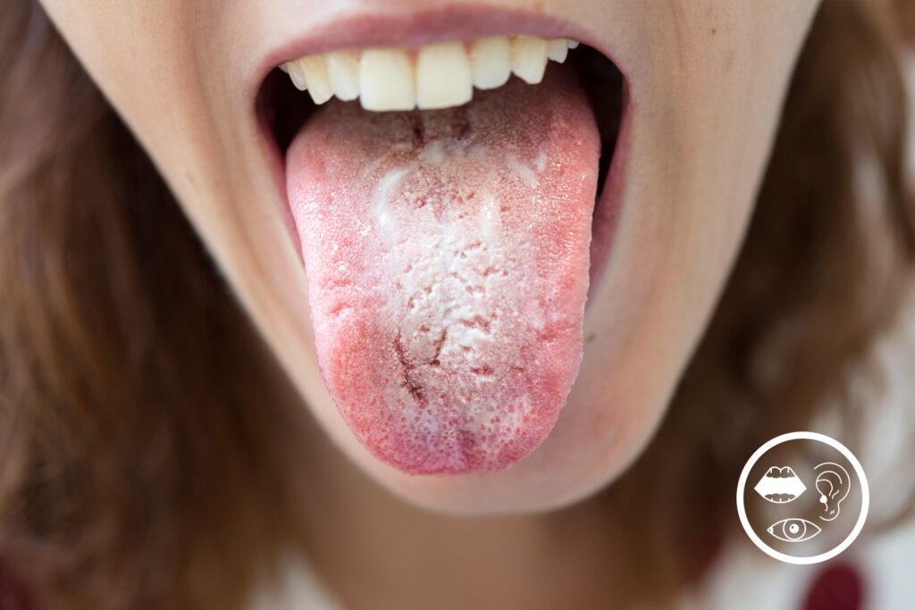 Close up photo of a woman sticking her tongue out, revealing a milky foam.