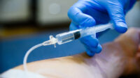 intravenous injection
