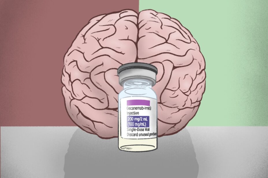 A vial of lecanemab in front of a brain, with a pro and con red/green background