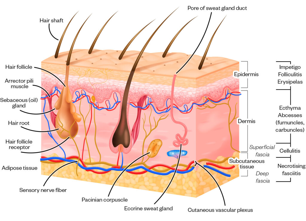 Illustration showing the different layers of skin, and the different conditions affecting each