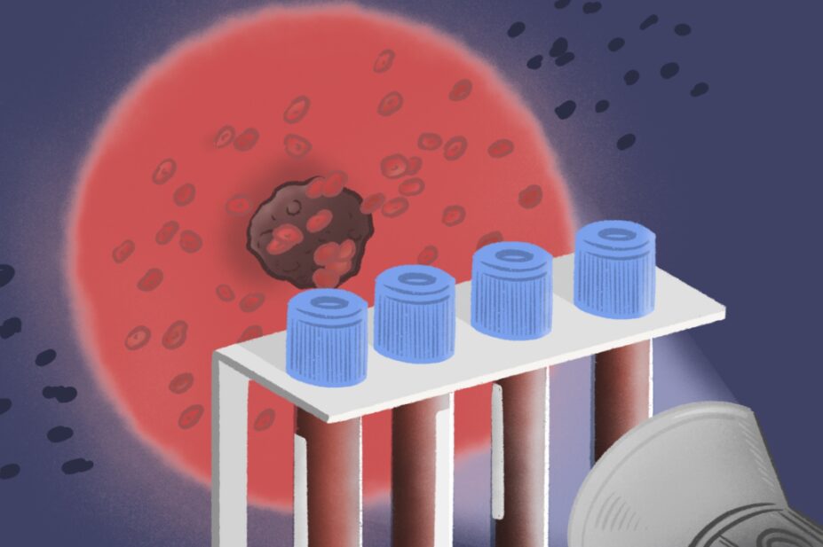 Illustration of a torch shining through a series of blood vials, revealing a cancer on the illuminated spotlight behind them.