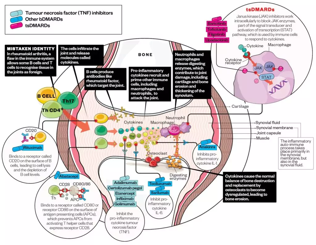 Rheumatoid arthritis: management - The Pharmaceutical Journal