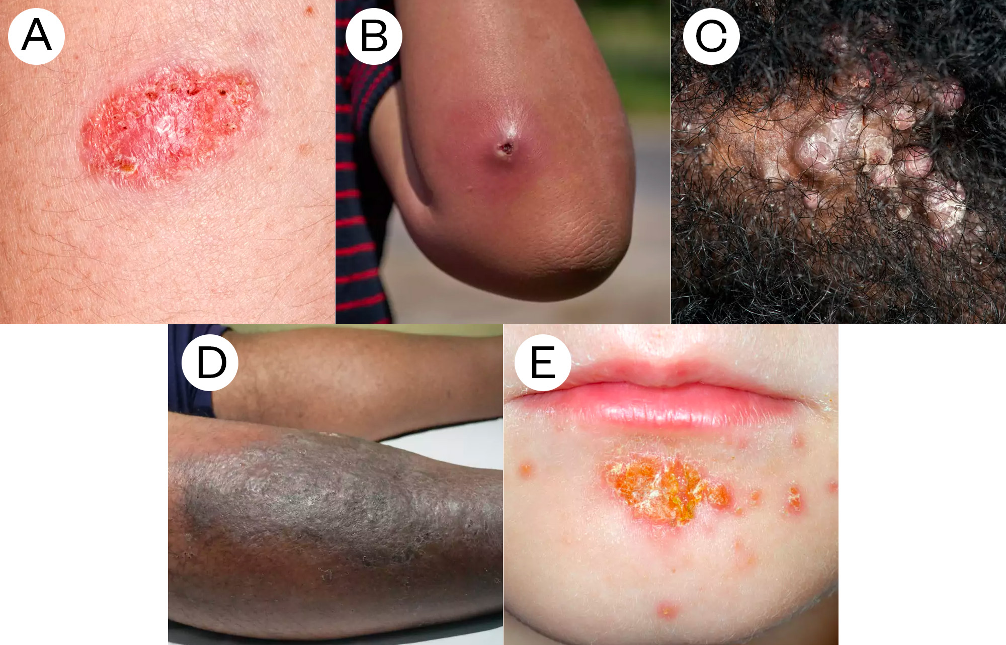 Photos of different kinds of skin and soft tissue infections