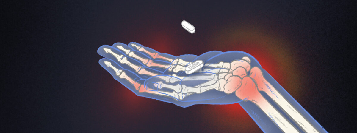 Illustration of a hand holding a ciprofloxacin tablet, with x-ray like vision of inflamed joints in the wrists and finger joints.