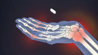 Illustration of a hand holding a ciprofloxacin tablet, with x-ray like vision of inflamed joints in the wrists and finger joints.