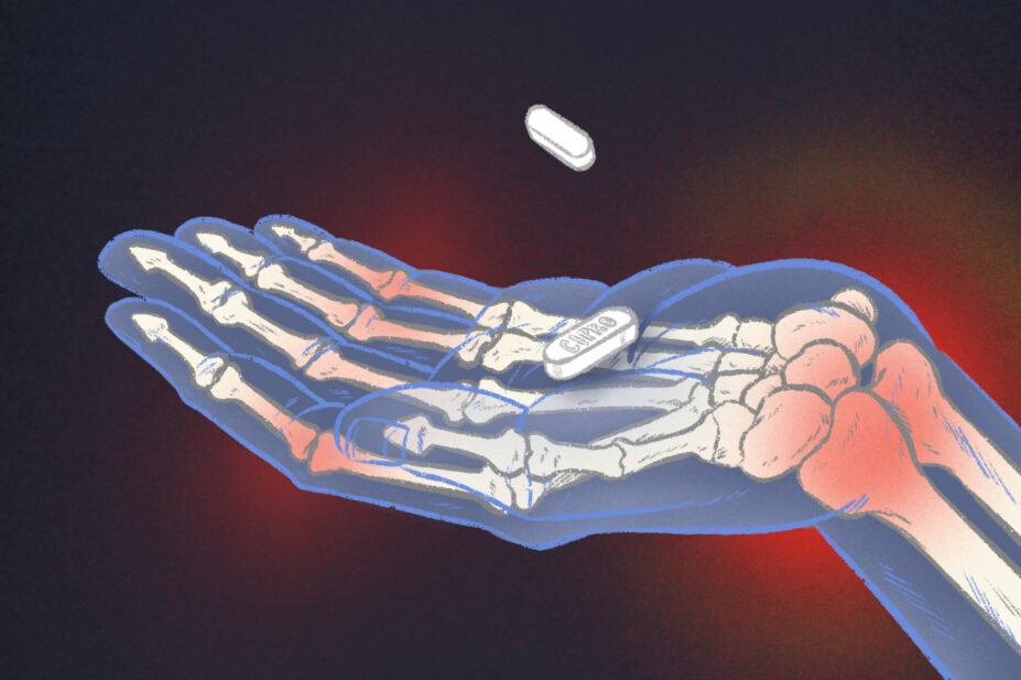 Illustration of a hand holding a ciprofloxacin tablet, with x-ray like vision of inflamed joints in the wrists and finger joints.