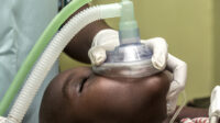 patient receiving anaesthetic gas