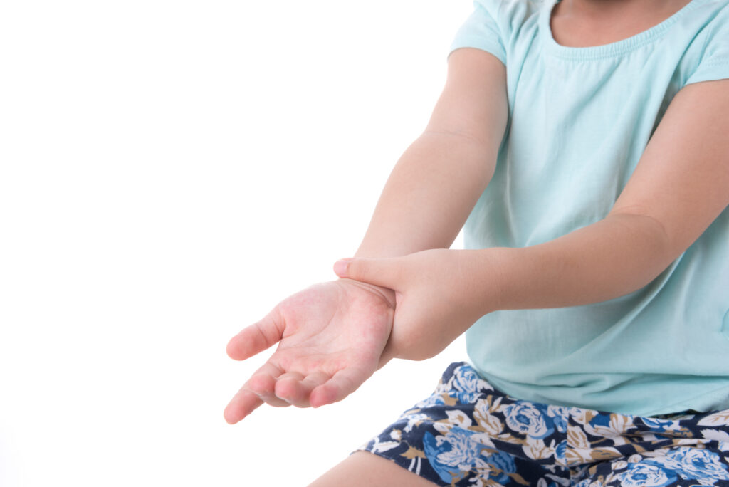 Photo of a child stretching an inflamed (highlighted in red) wrist