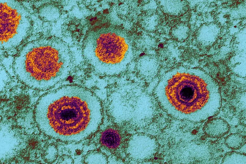 Coloured transmission electron micrograph (TEM) of herpes virus particles in infected tissue