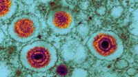 Coloured transmission electron micrograph (TEM) of herpes virus particles in infected tissue