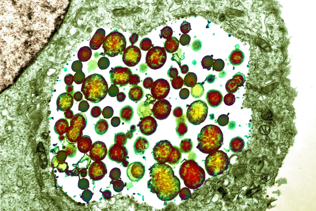 Coloured transmission electron micrograph (TEM) of Chlamydia trachomatis bacteria (red/yellow) inside a cell (green).