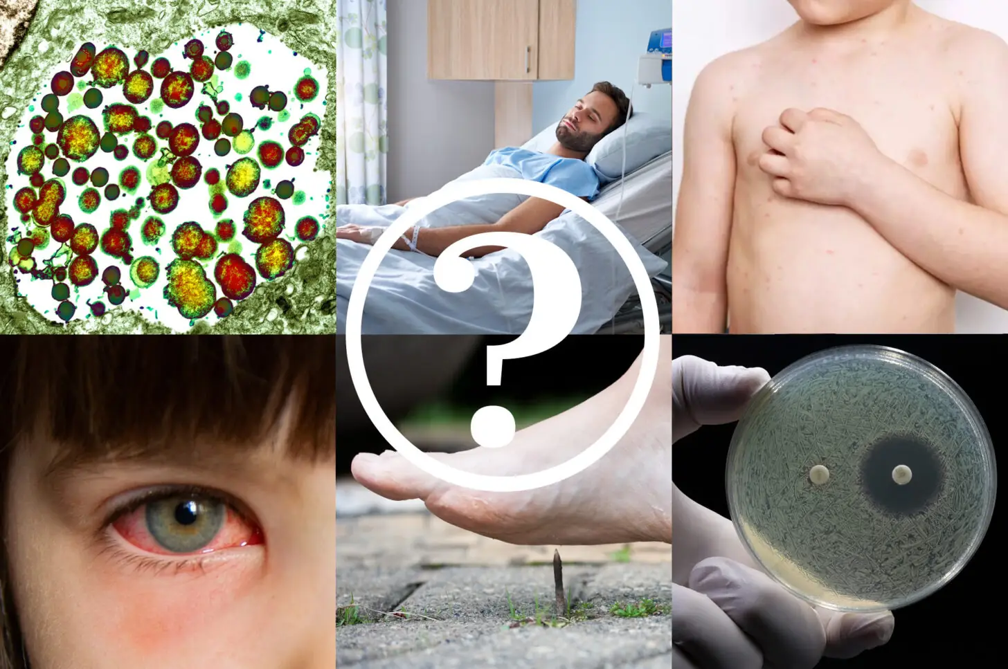 Test your knowledge of infectious diseases - The Pharmaceutical Journal