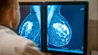 Physician looking at mammogram scan