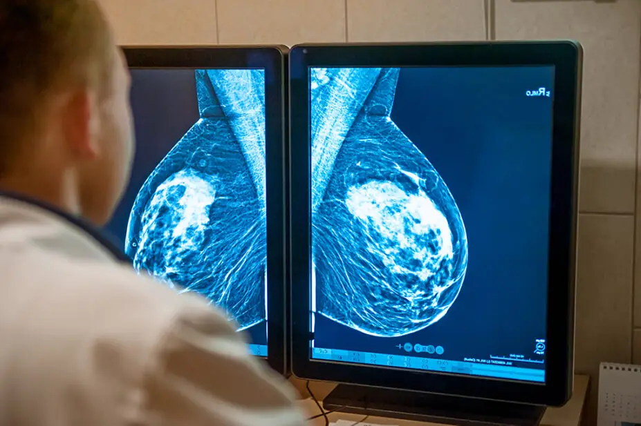 Physician looking at mammogram scan