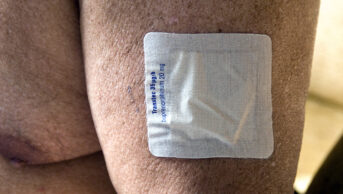 Transdermal buprenorphine patch on the arm of an older man