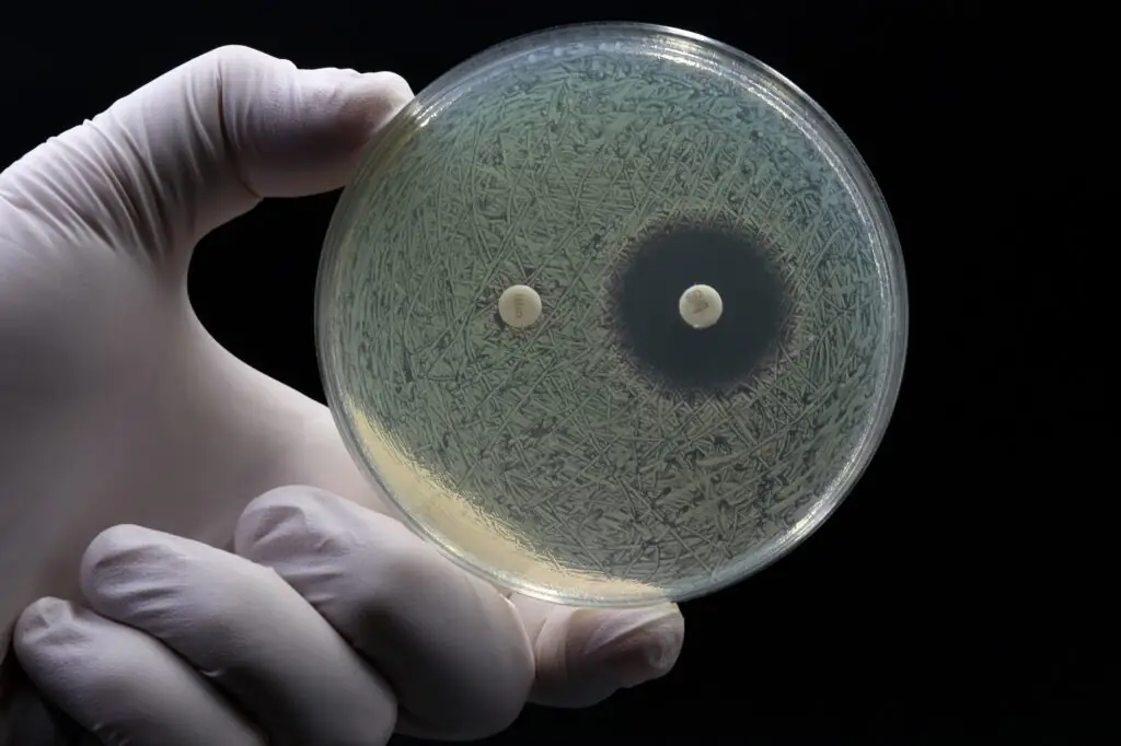 A doctor's or researcher's hand holding a Petri dish with a culture of bacteria on which an antibiotic disc test is performed