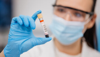 Someone working in a laboratory with a blood vial