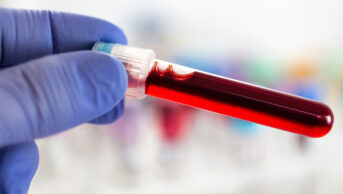 Blood sample in laboratory