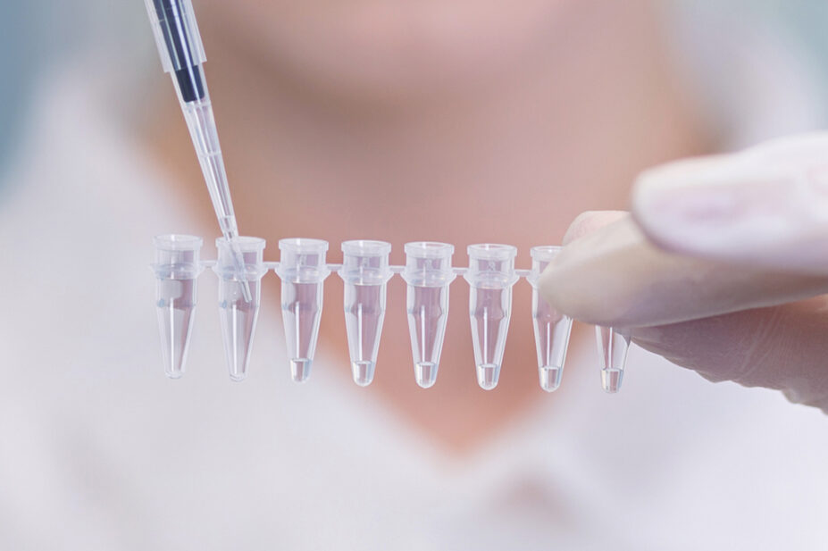 Saliva sampling in a laboratory