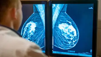 Doctor examining mammogram images