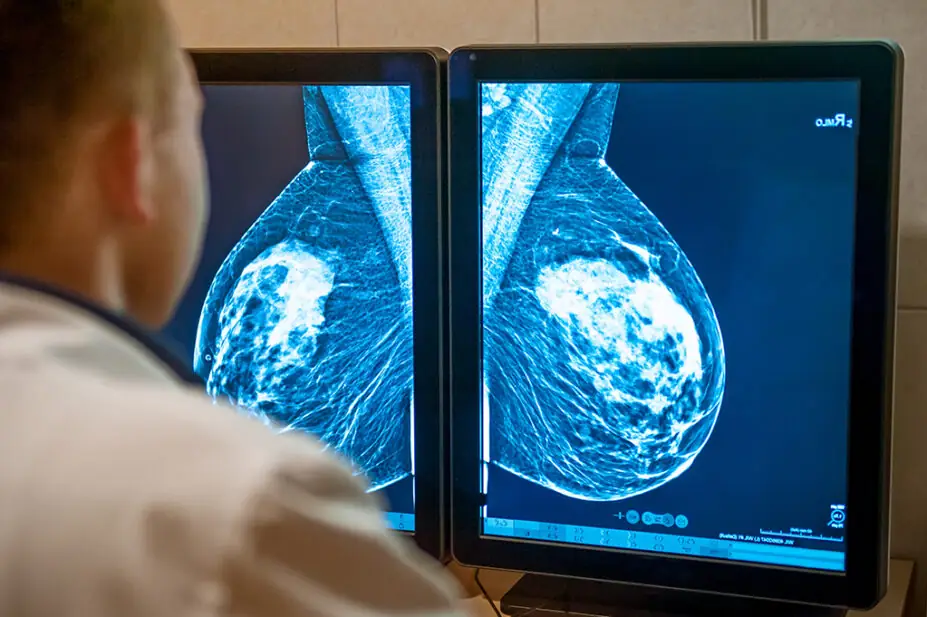 Doctor examining mammogram images