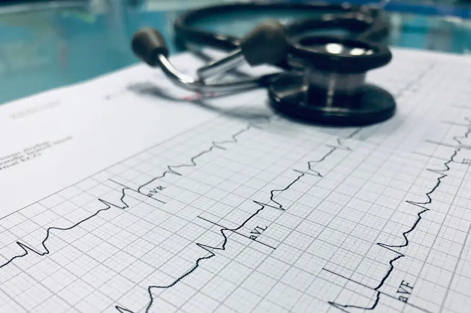 Stethoscope and ECG chart