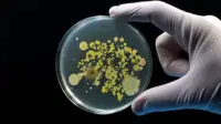 A Petri dish containing bacteria