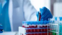 Scientist holds a blood sample in a test tube