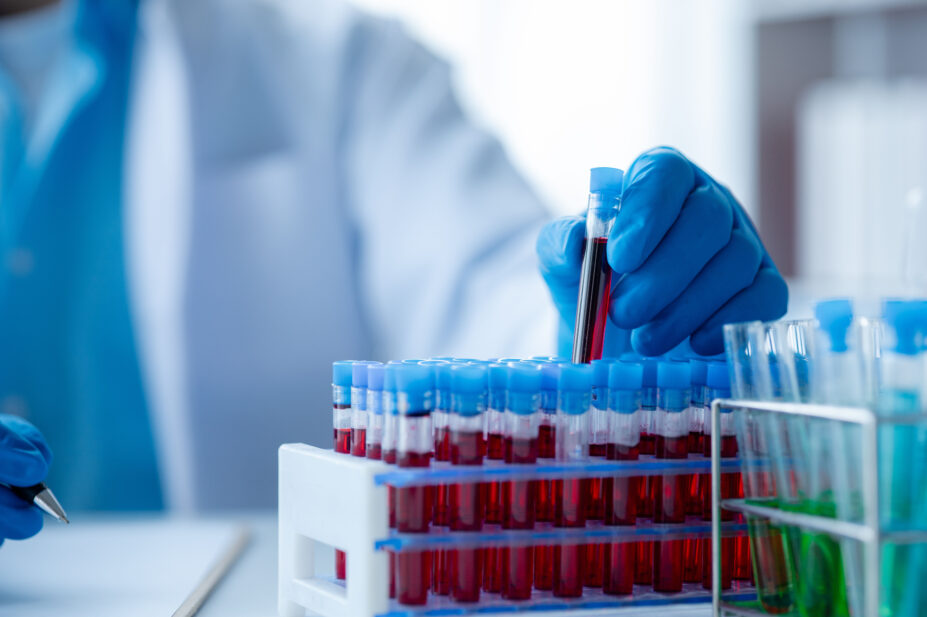 Scientist holds a blood sample in a test tube