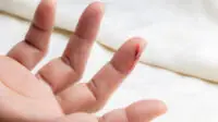 A finger bleeding from a cut