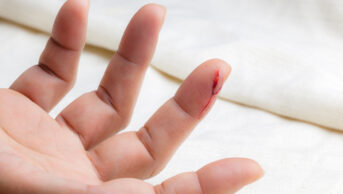 A finger bleeding from a cut