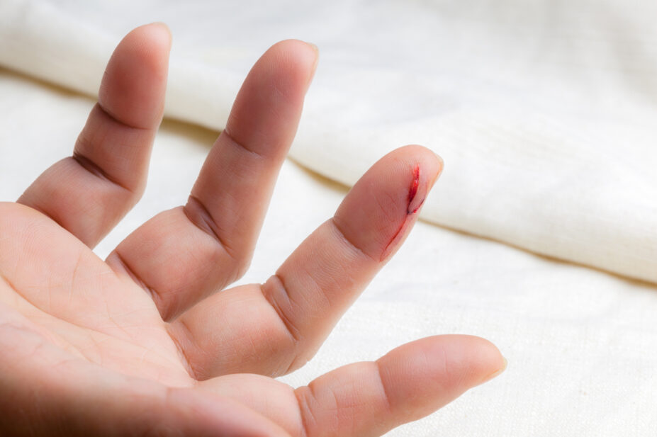 A finger bleeding from a cut