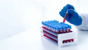 Scientist holds a blood sample in a test tube