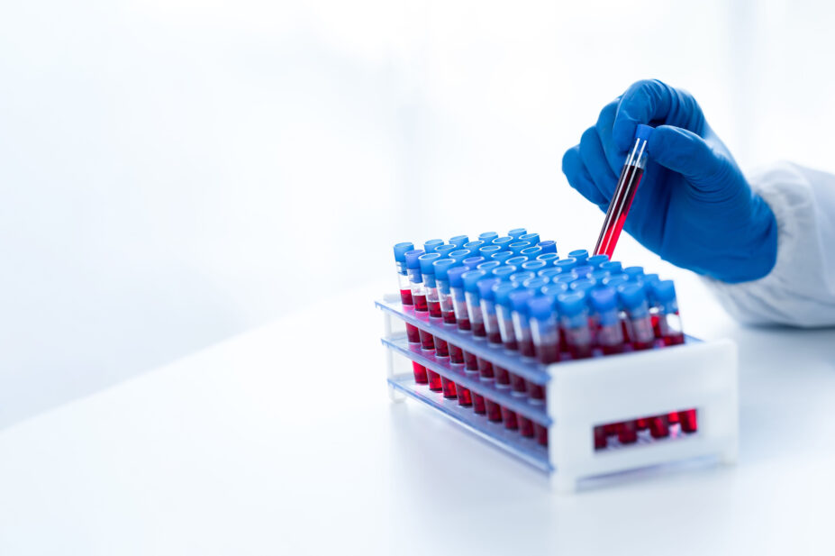 Scientist holds a blood sample in a test tube