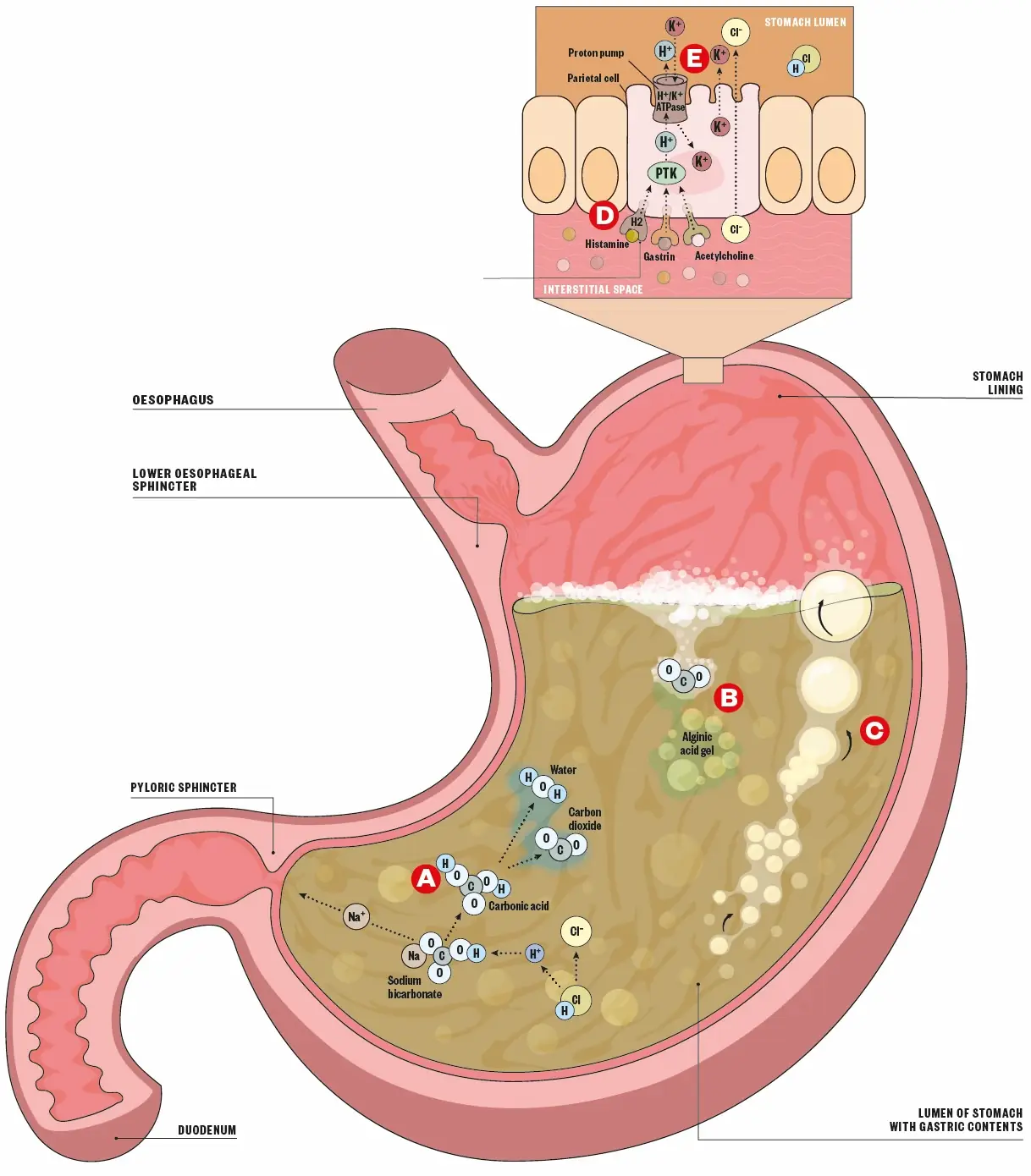 Diagram of a stomach