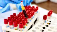 Blood samples in laboratory