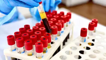 Blood samples in laboratory