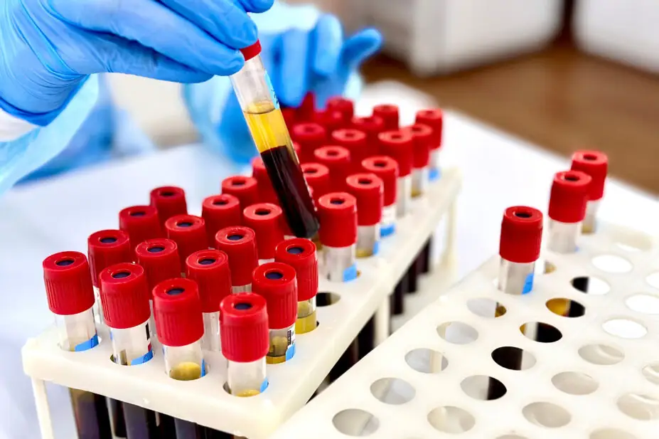 Blood samples in laboratory