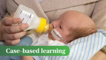 Photo of a baby on a feeding tube, being fed formula