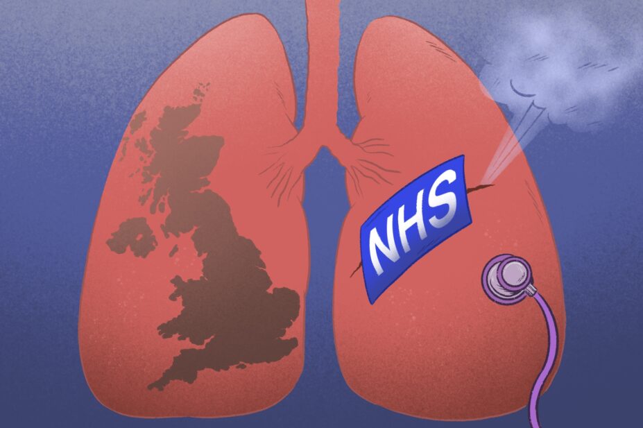 Illustration of a pair of lungs with the UK in the left lung and a leak in the right being plugged by the NHS logo and a stethoscope