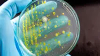 A bacteria sample