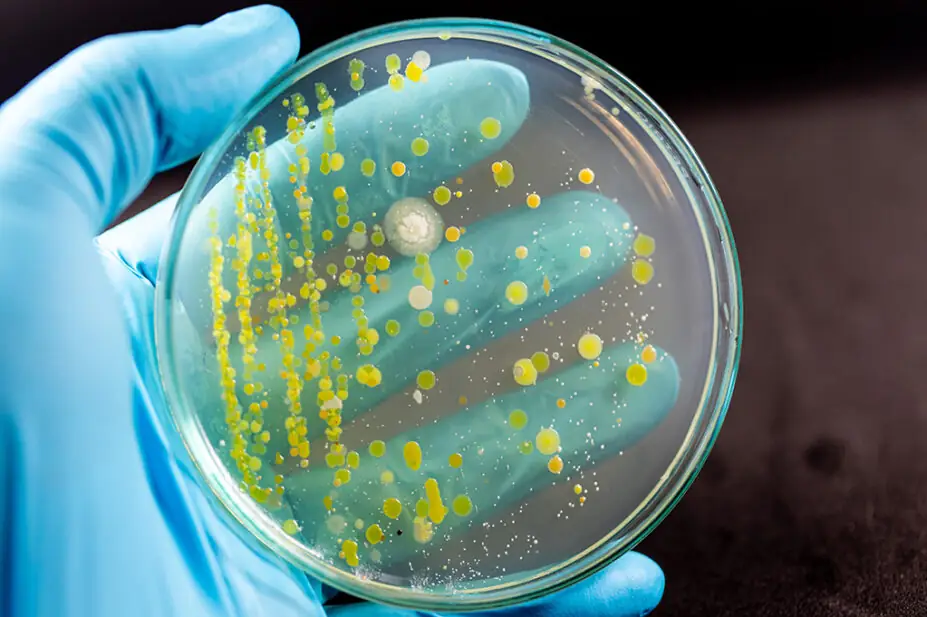 A bacteria sample