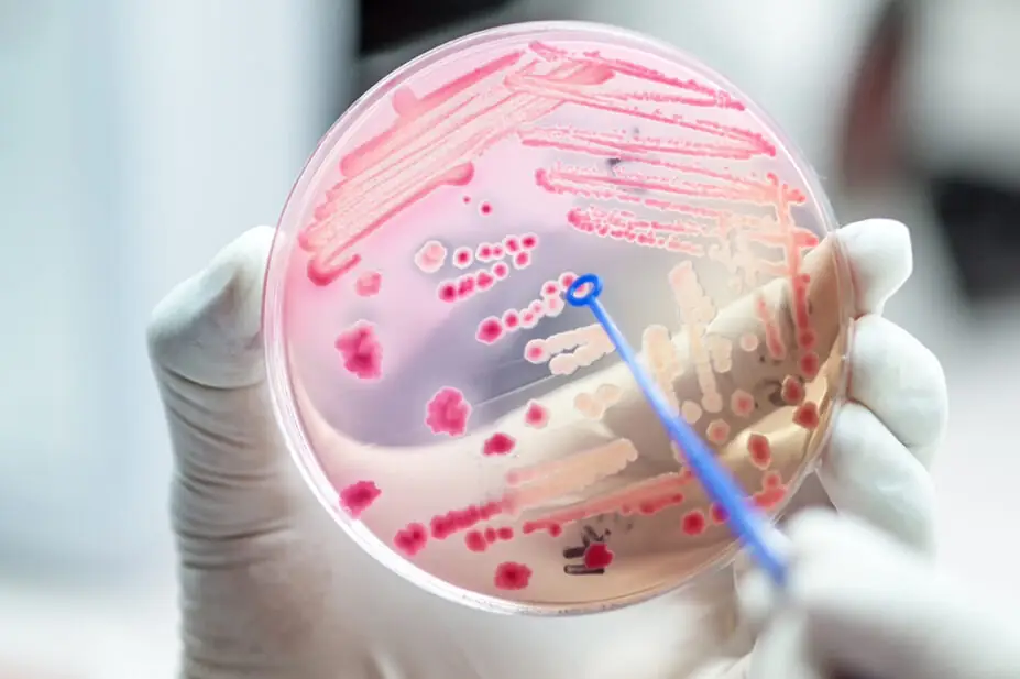 A Petri dish containing bacteria
