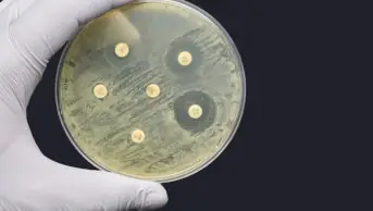 A hand holding a bacteria sample