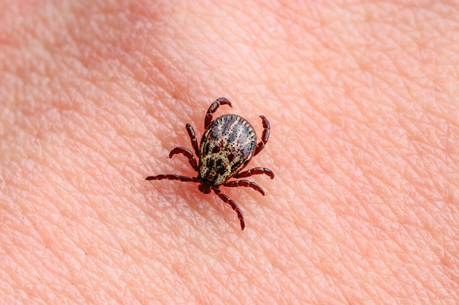 An image of a tick biting the skin of a person