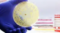 A bacteria sample