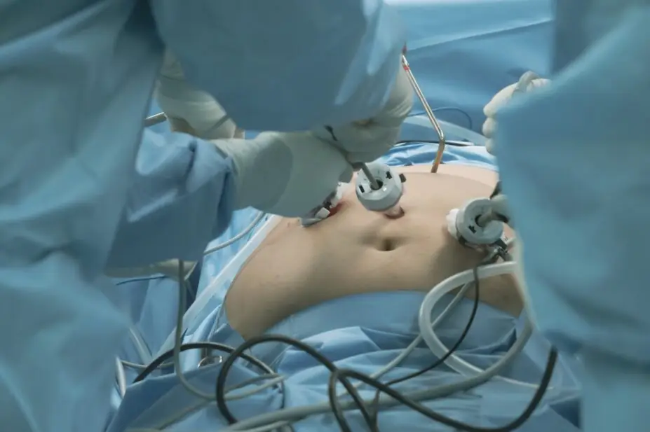Surgeon team during bariatric surgery with laparoscopic instruments in the operating room