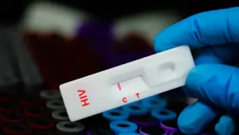 A close up of a HIV rapid diagnostic test
