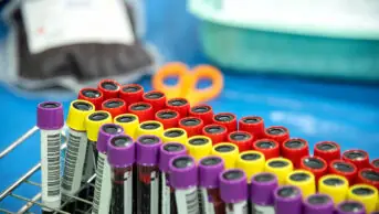 A collection of blood samples in tubes